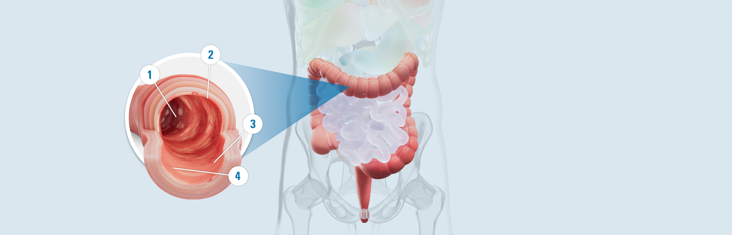 Illustrated colon with signs of repair: 1. Fewer ulcers. 2. Less redness. 3. Less bleeding. 4. Smooth lining.